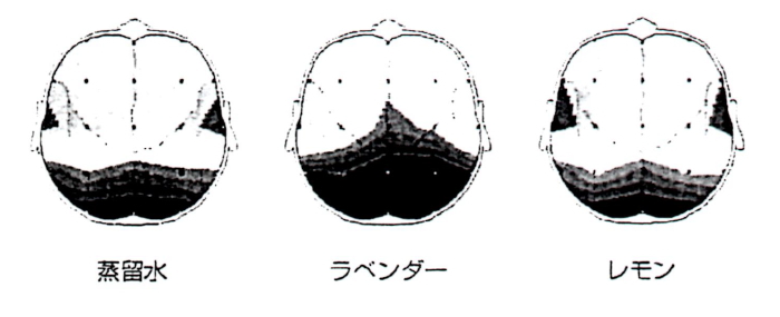 トポグラフ図